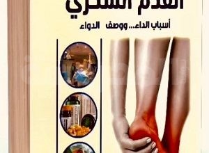 كتاب القدم السكرى